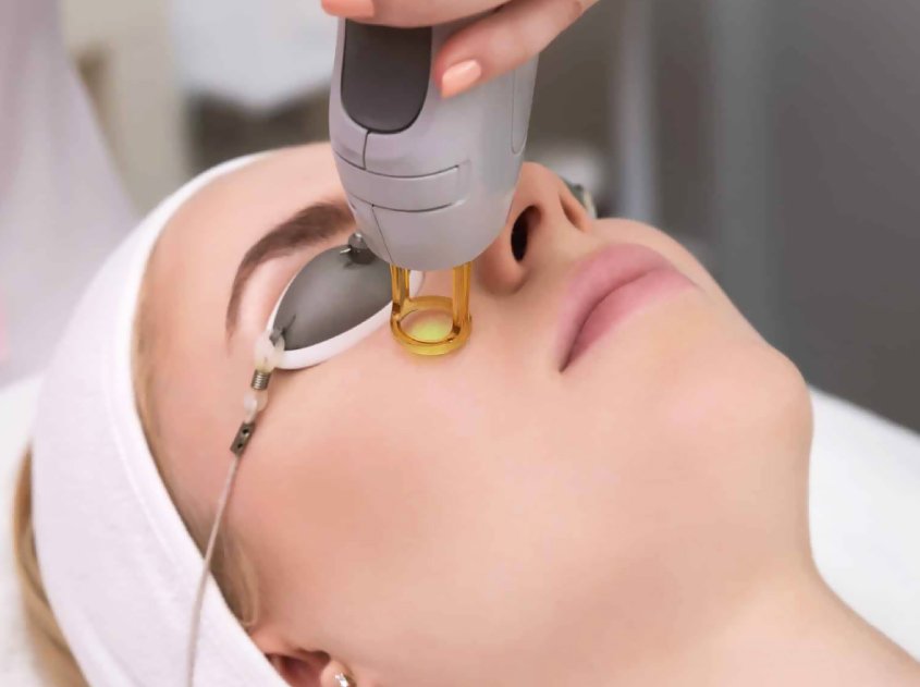 Dubai Laser Tightening: Safe & Effective